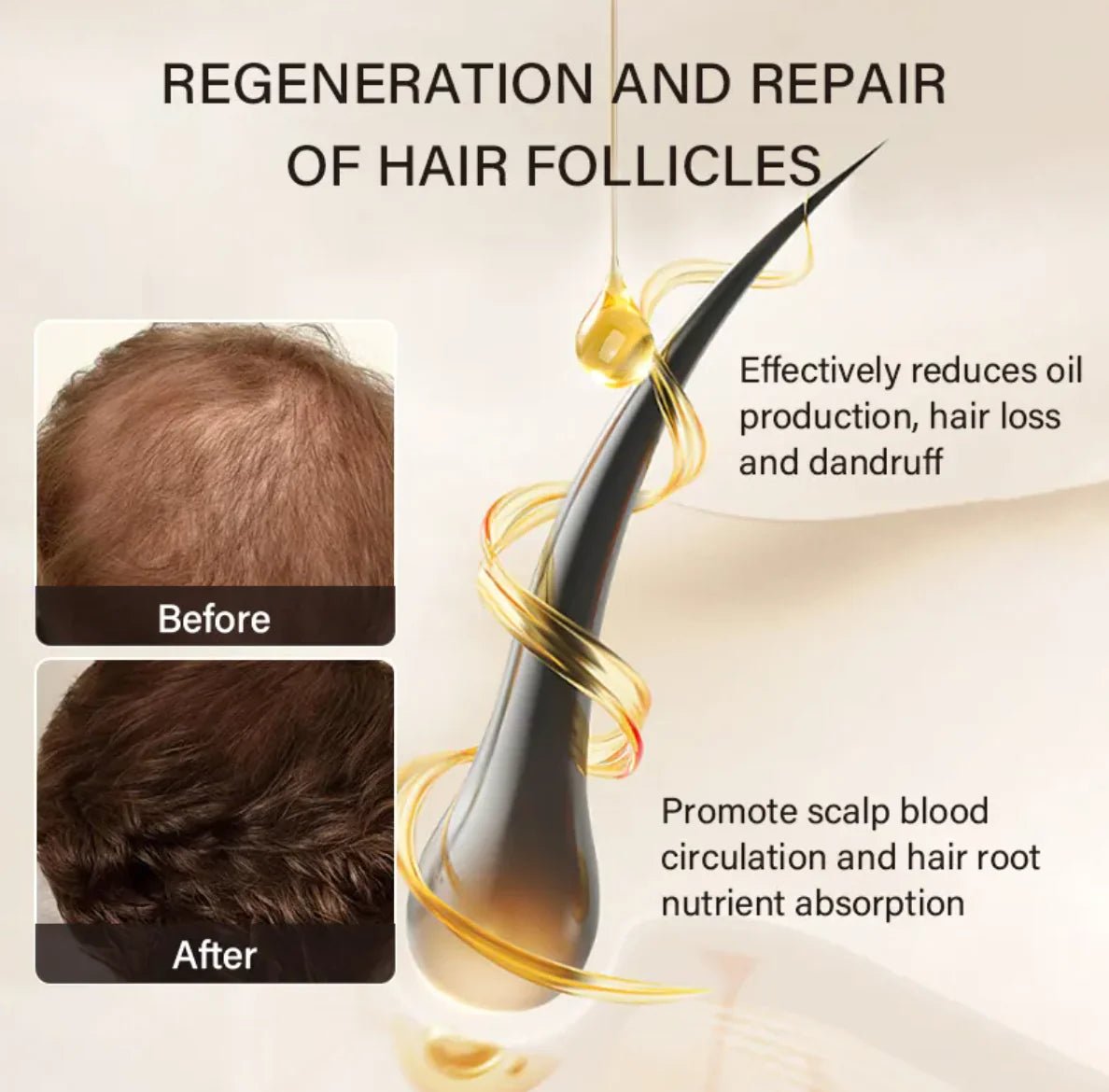 KORVEX Castor OilKORVEXRGYO1AYMOOYAM Castor OilKORVEX Castor OilKORVEX