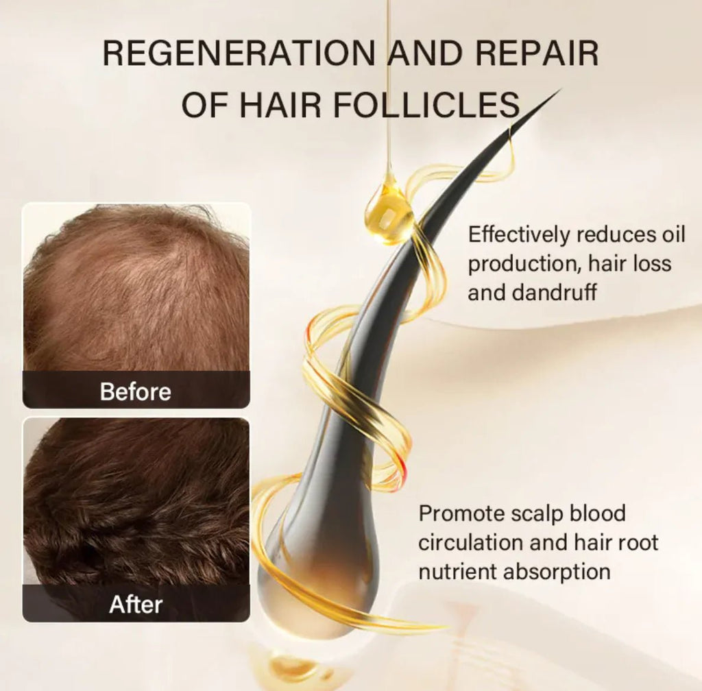 KORVEX Castor OilKORVEXRGYO1AYMOOYAM Castor OilKORVEX Castor OilKORVEX